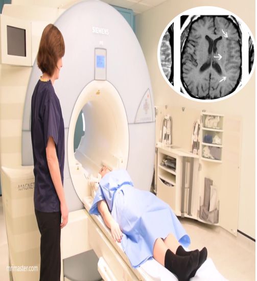 MRI Stroke Protocol + Perfusion Imaging